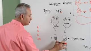 Blood Transfusion Reaction Part 13 Hematology [upl. by Donough]