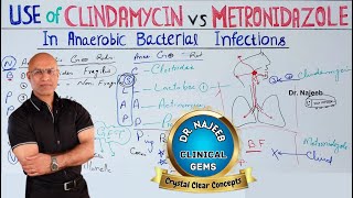 Clindamycin vs Metronidazole  Anaerobic Infection  Pharmacology💊 [upl. by Lessur]