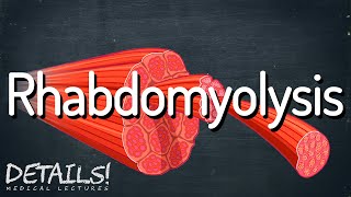 Rhabdomyolysis  Details [upl. by Kalasky578]