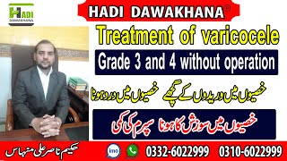 Grade 2 varicocele treatment without surgery in Urdu  Hindi  Varicocele Ka ilaj  Varicocele [upl. by Toogood203]