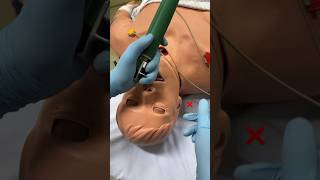 How to intubate anesthesiologist anesthesia nursing [upl. by Domella344]