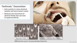 Teethmate Desensitizer [upl. by Lundell285]