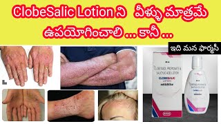 clobesalic lotion in telugu  uses sideeffects precautions etc clobetasol  salicylic acid [upl. by Anilatak299]