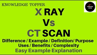 Difference between X Ray and CT Scan  X Ray vs CT Scan  What is X ray  What is CT Scan [upl. by Dunham]