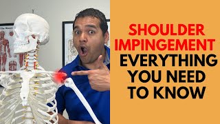 Shoulder Impingement Everything You Need To Know To Get Healthy Again [upl. by Croydon]