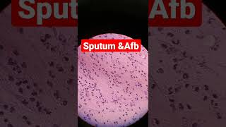 sputum for AFB Test  Afb stain  zn stain viral youtubeshorts sorts dmlt [upl. by Ahsatak]