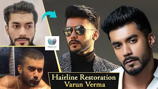 Actor Varun Vermas Hair Restoration  Medlinks Reviews  Dr Gaurang Krishna Results [upl. by Negriv]