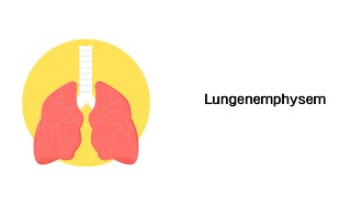 Lungenemphysem  Erkrankungen der Atemwege [upl. by Serle]