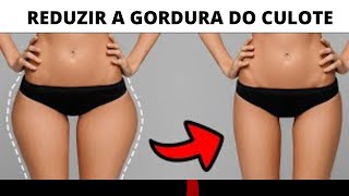 Como Perder Culote Rápido e reduzir a gordura do culote  TML  Totalmente Leve [upl. by Parke147]