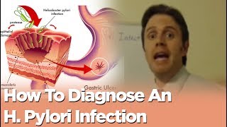 How To Diagnose An H Pylori Infection [upl. by Anaet112]