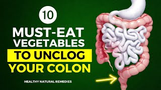 10 MustEat Vegetables To Unclog Your Colon [upl. by Doggett]