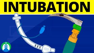 Intubation Medical Definition  Quick Explainer Video [upl. by Ettennan]