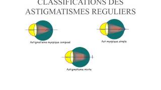 BIOPHYSIQUE Astigmatisme [upl. by Yblocaj]