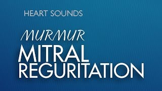 Mitral Regurgitation Murmur  Well Summarized alongwith MR Audio  Heart Sounds Made Easy [upl. by Rebecca944]