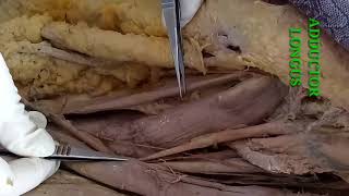 DISSECTION OF FRONT OF THIGH PART1 BY DR MITESH DAVE [upl. by Aguie917]