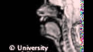 Voiced uvular nasal MRI [upl. by Imelda]