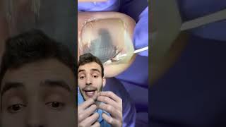 Hematoma subungueal curiosidades sabiasque [upl. by Rehtul]