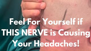 How to Check To See if Your Chronic headache is Coming from an Occipital Nerve Entrapment [upl. by Yraht]