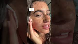 We can remove freckles 🥵 beautyproducts modelskincare beauty makeup freckles [upl. by Ayvid643]