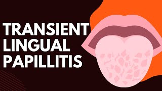 Transient Lingual Papillitis 5 Definitive Symptoms [upl. by Ilahtan]