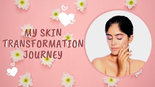 My Acne Journey and SkinCare Tips  StoryTime  Nikita Tanwani [upl. by Charley972]