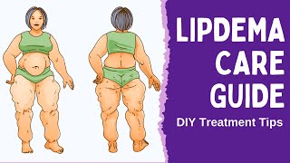 The Beginners Guide To Lipedema  How to Manage Lipedema at Home [upl. by Savihc]