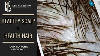 HEALTHY SCALP  HEALTHY HAIR  TRICHOLOGY [upl. by Zacharie]