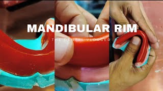 Fabrication of Mandibular Occlusal Rim  Step by step  SO EASY  Prosthodontics [upl. by Allecram]