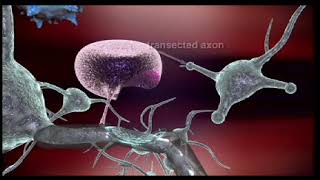 Mechanism of Action of Natalizumab a medication used to treat multiple sclerosis amp Crohns disease [upl. by Obidiah]