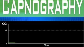 EtCO2 Capnography Part 5 [upl. by Irvin]