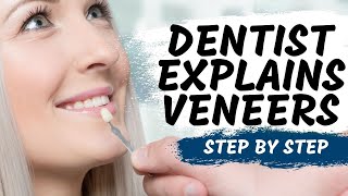 Porcelain Veneers Procedure Explained [upl. by Marlette]