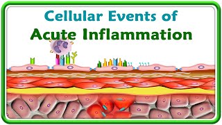 3 Cellular events of Acute Inflammation  Animation [upl. by Tyree]