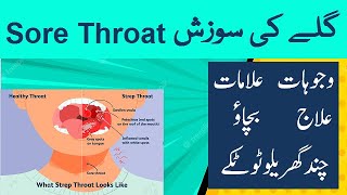 Sore Throat  Causes Symptoms Treatment Prevention and Cautions  Urdu  Hindi  Shahbaz Qamar [upl. by Steve]