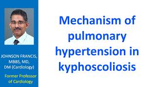 Mechanism of pulmonary hypertension in kyphoscoliosis [upl. by Angy163]