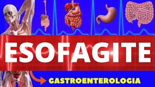 ESOFAGITE  O QUE É CAUSAS SINTOMAS DIAGNÓSTICO E TRATAMENTO  GASTROENTEROLOGIA [upl. by Aizirtap]