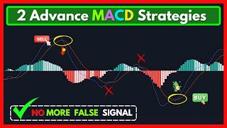 MACD Indicator Explained 2 Advanced Strategy [upl. by O'Grady721]