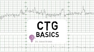 CTG Basics [upl. by Ahkeber]