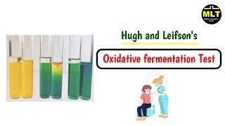 Oxidative fermenatative test bacteria  hugh and leifson test biochemical test [upl. by Odranreb303]