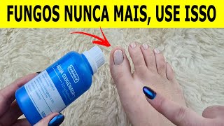 NUNCA MAIS TIVE FUNGOS E MICOSE NAS UNHAS DEPOIS QUE VI ESSA RECEITA [upl. by Dorette]