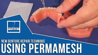 New Denture Repair Technique Using Perma Mesh By PREAT Corporation [upl. by Grounds887]