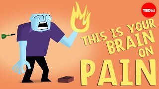 How does your brain respond to pain  Karen D Davis [upl. by Thevenot291]