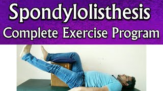 Spondylolisthesis EXERCISES  Effective Exercises For Spondylolisthesis TREATMENT At Home Naturally [upl. by Ardnassac]