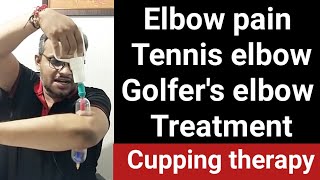 elbow pain stiffness tennis elbow golfers elbow cupping therapy shorts apakahealthguru [upl. by Downing]