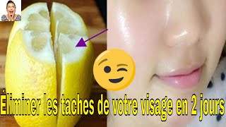 Voici Comment Utilisez le citron pour éliminer les taches de votre visage en 2 jours [upl. by Geddes]