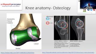 Biomechanics of Knee Replacement [upl. by Budde]