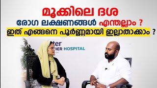 കുട്ടികളിലെ മൂക്കിൽ ദശ എങ്ങനെ പൂർണ്ണമായി ഇല്ലാതാക്കാം  Adenoids  Arogyam [upl. by Eatnoj]