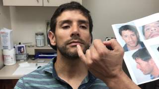 Male Rhinoplasty  Correcting the Twisted Nose  Dr Jeffrey Epstein [upl. by Libnah]