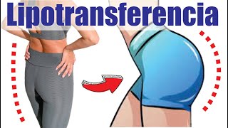 LIPOTRANSFERENCIA o LIPOINJERTO a glúteos mamas piernas y rostro 🤩 DR ALBERTO CALVO QUIROZ [upl. by Rihaz]