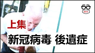 得到新冠病毒會有什麼後遺症 COVID急性後症候群Long COVID 大解析上 輕症也可能有後遺症喔！ [upl. by Onin]