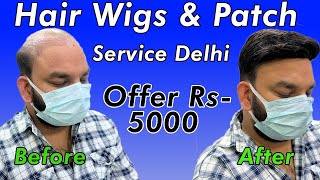 Hair Wig Services In Delhi  Hair Wig Service Delhi NCR  Monofilament Hair Wigs In Delhi [upl. by Macintyre]